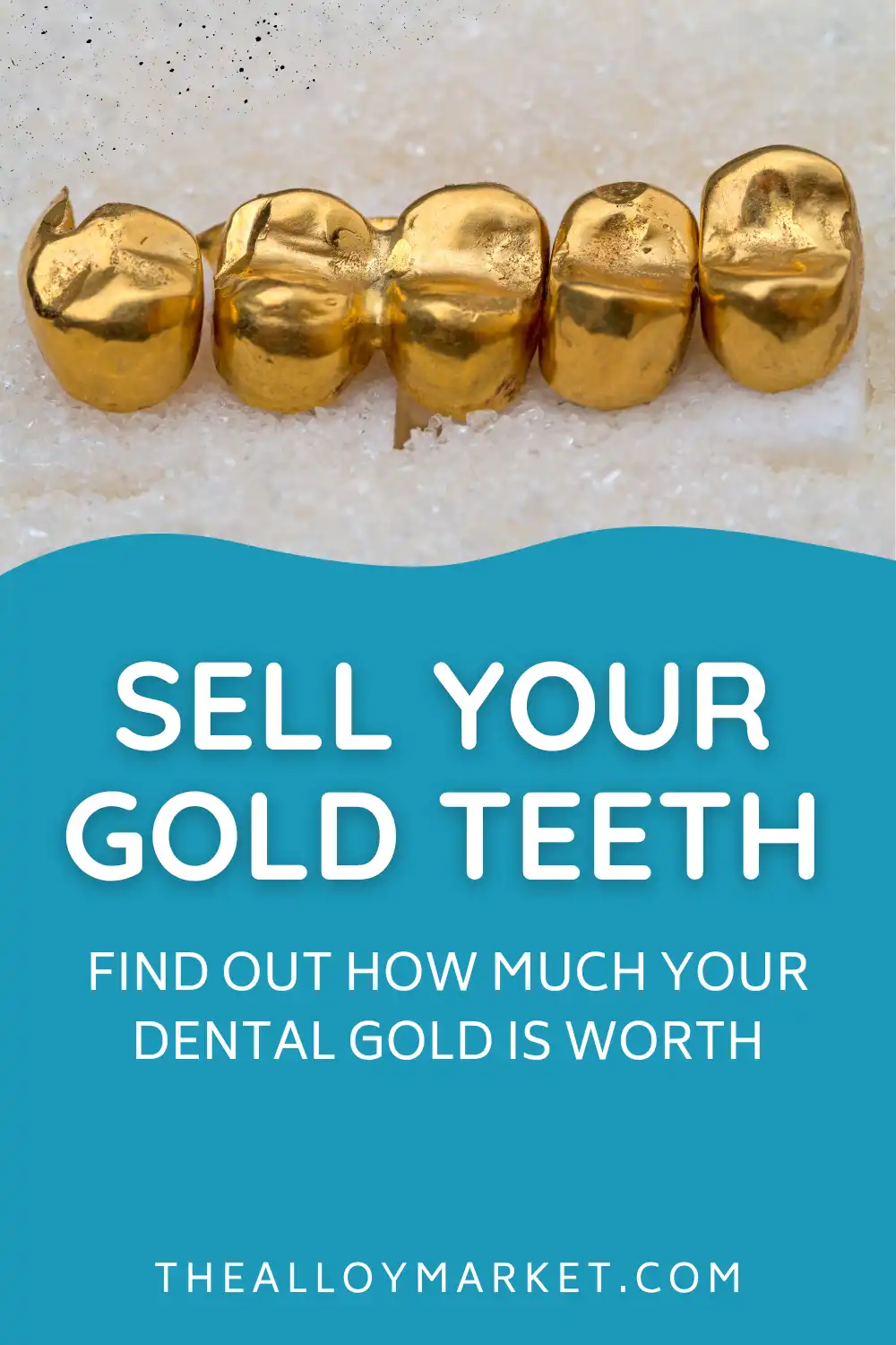 Can you really sell your dental gold? Yes! Find out how much it's worth