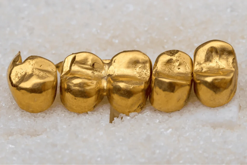 Can you sell gold teeth? Yes you can!