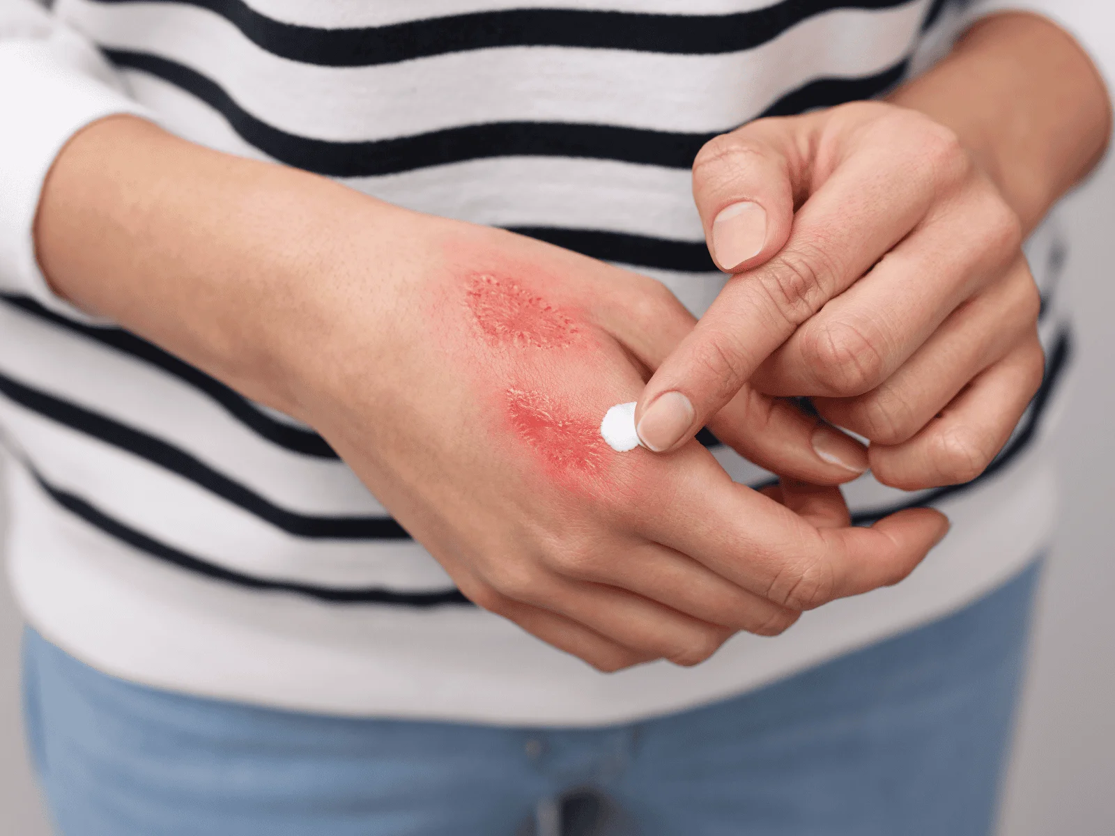 be careful when testing gold with a lighter