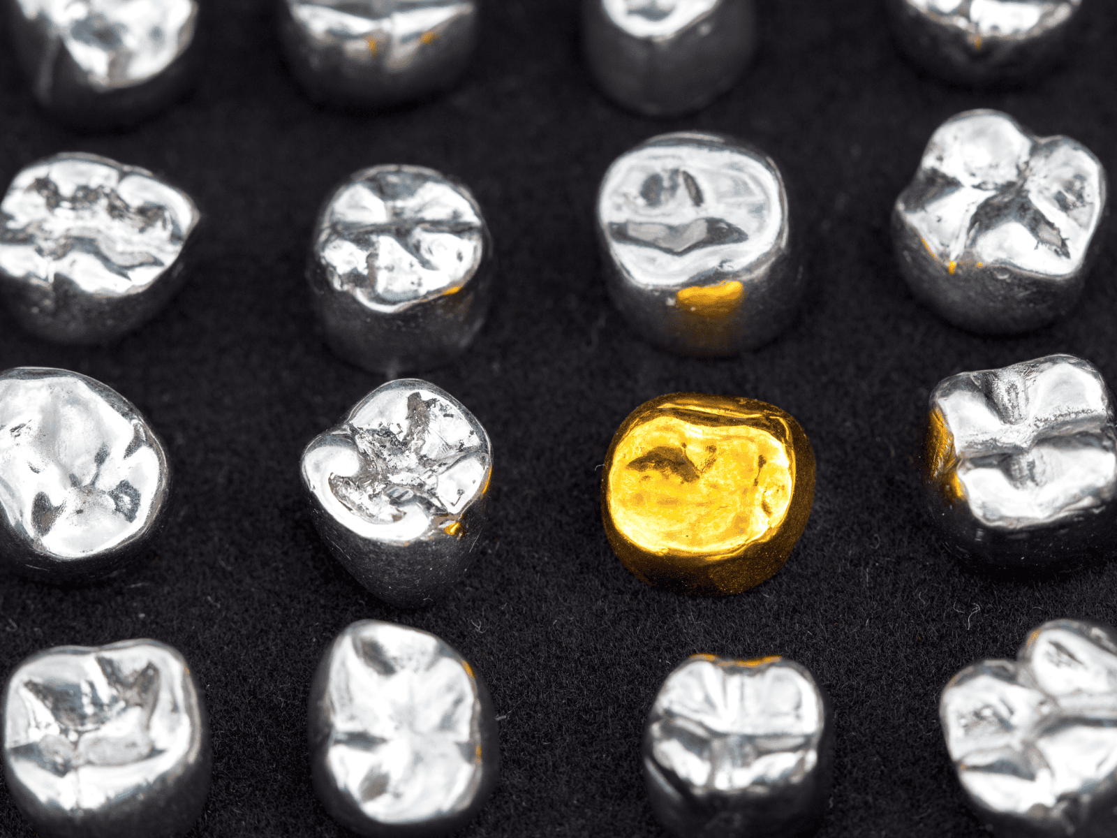 where to sell dental gold