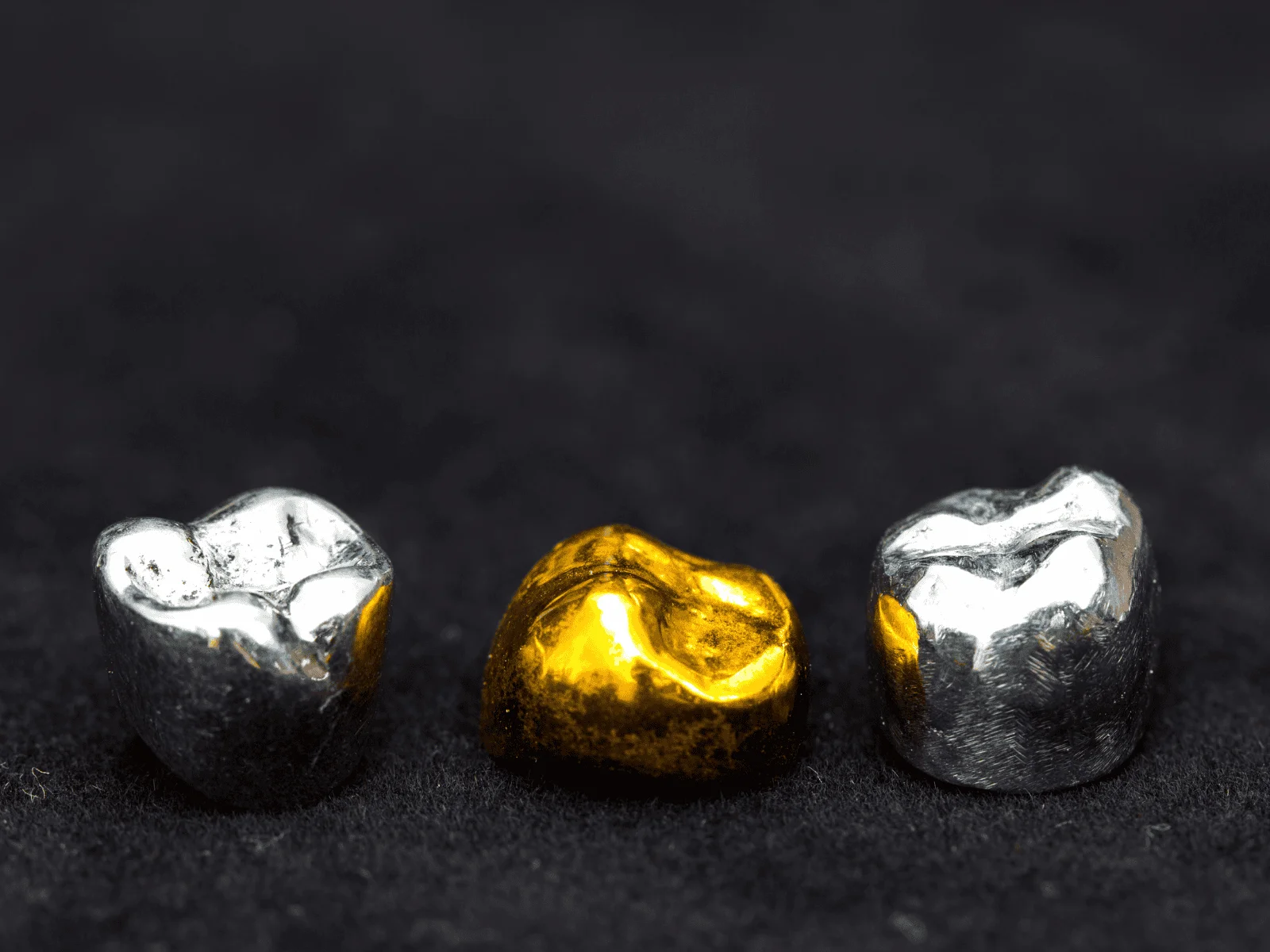 gold and silver teeth