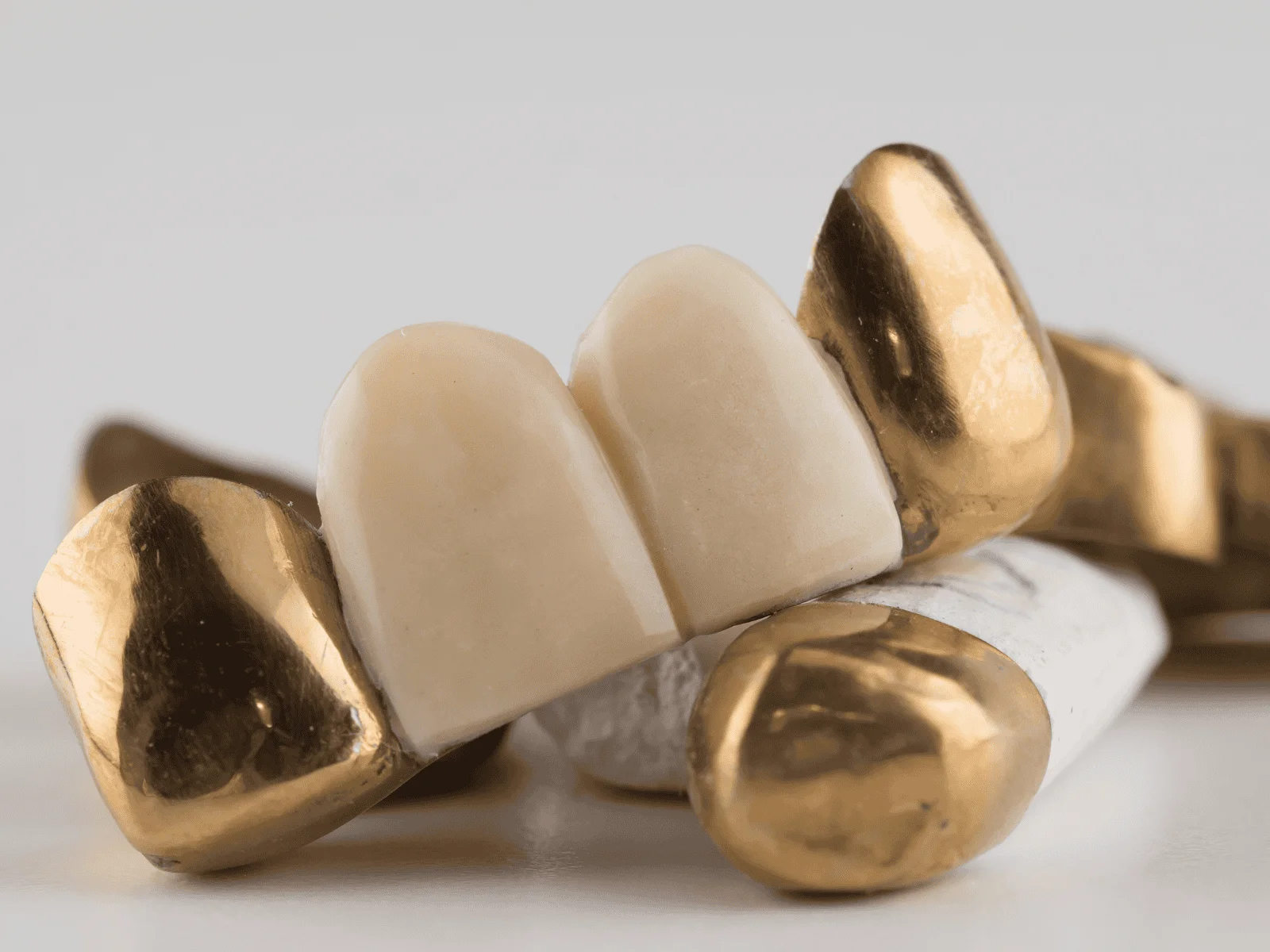 where to sell dental gold