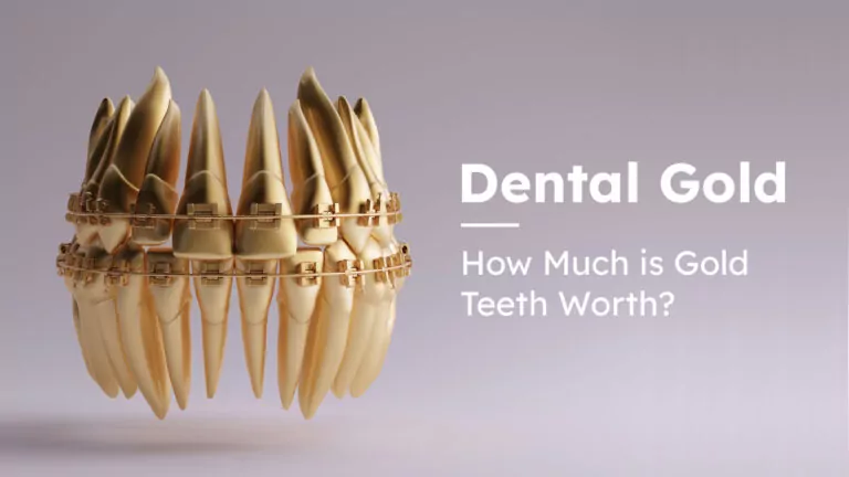 Dental Gold: How Much is Gold Teeth Worth?